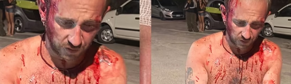 Olbia, aggressione omofoba dopo una serata a Porto Istana: «Trenta contro uno»