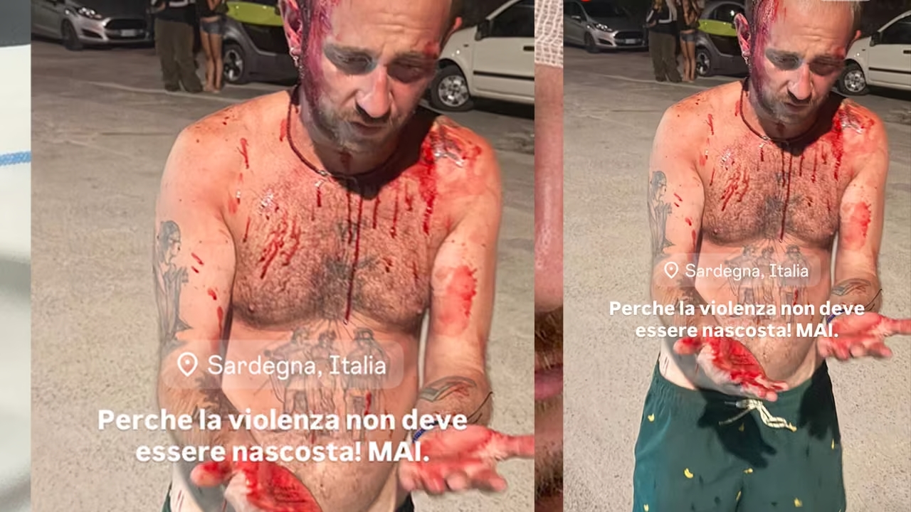 Olbia, aggressione omofoba dopo una serata a Porto Istana: «Trenta contro uno»